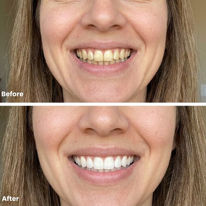 VitaLux Color Correcting Purple Mouthwash