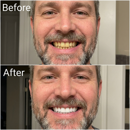 VitaLux Color Correcting Purple Mouthwash