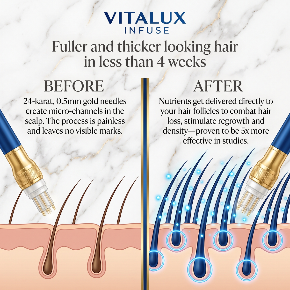 VitaLux Microneedle Infusion Kit